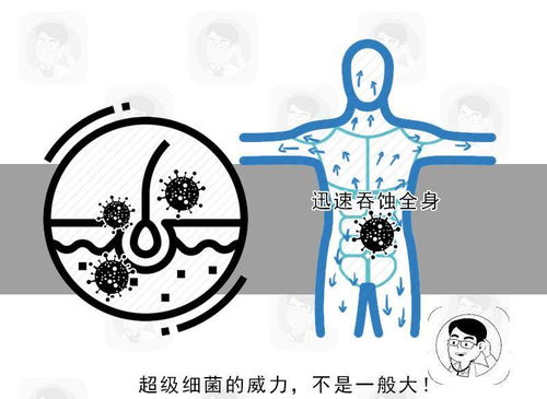 被虾尾刺破手，为何会引起脏器衰竭？警惕“食肉菌”感染的致命威胁